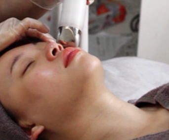 Ageless Allure: The Marvels of Collagen Facial in Singapore