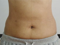 Before & After: Abdomen