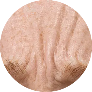 Early signs of aging or skin starting to lose firmness