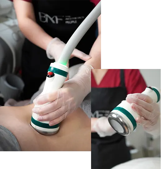 Coolwaves™ with two handles