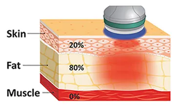 Skin Tissue